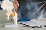 The Silent Progression of Labral Tears: Why Symptoms Don’t Always Match Damage