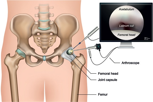 Why You Don't Want To Bump Your Hips 